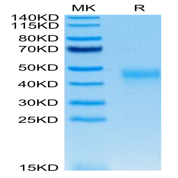 Human KIR2DL2 Protein (KIR-HM4L2)