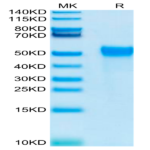 Biotinylated Human KIR2DL2 Protein (KIR-HM4L2B)