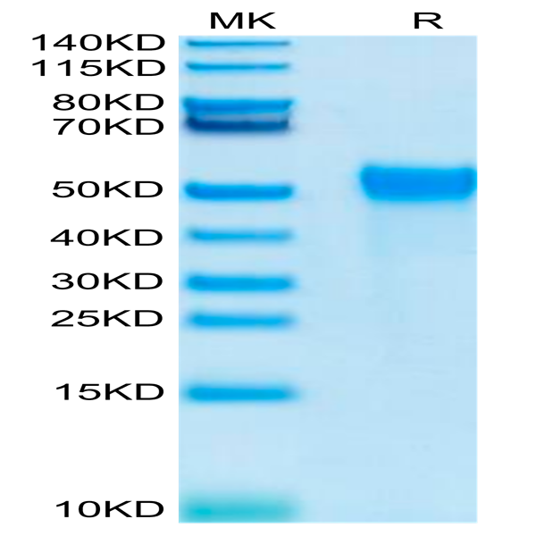 Biotinylated Human KIR2DL2 Protein (KIR-HM4L2B)