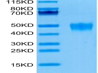 Human KIR2DL5 Protein (KIR-HM4L5)