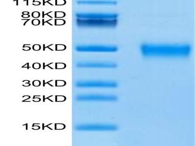Biotinylated Human KIR2DL5 Protein (KIR-HM4L5B)