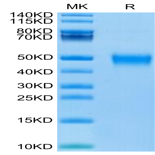 Human KIR2DL5 Protein (KIR-HM4L5)
