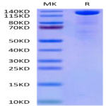 Mouse Beta Klotho Protein (KLB-MM101)