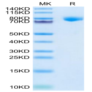 Cynomolgus KLKB1 Protein (KLK-CM1B1)
