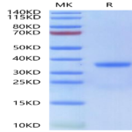 Human Kallikrein 3/PSA Protein (KLK-HM103)