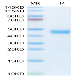 Mouse Kallikrein 5/KLK5 Protein (KLK-MM105)