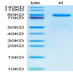 Mouse KLKB1 Protein (KLK-MM1B1)