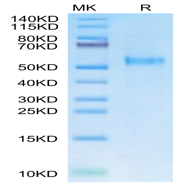 Rhesus macaque KIR3DL2 Protein (KR3-CM1L2)