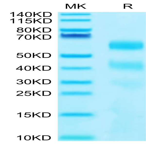 Human KIR3DL2 Protein (KR3-HM4L2)