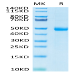Human KIR3DL3 Protein (KR3-HM4L3)