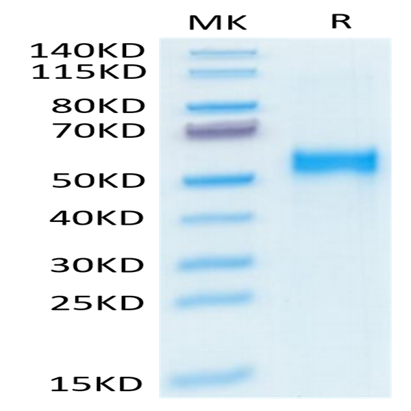 Human Kremen-2 Protein (KRE-HM102)