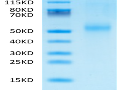 Mouse Kremen-2 Protein (KRE-MM102)