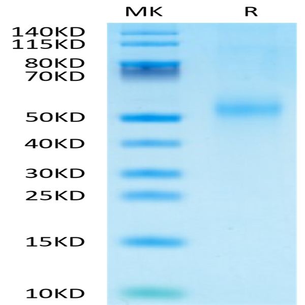 Mouse Kremen-2 Protein (KRE-MM102) Mouse Kremen-2 Protein (KRE-MM102)
