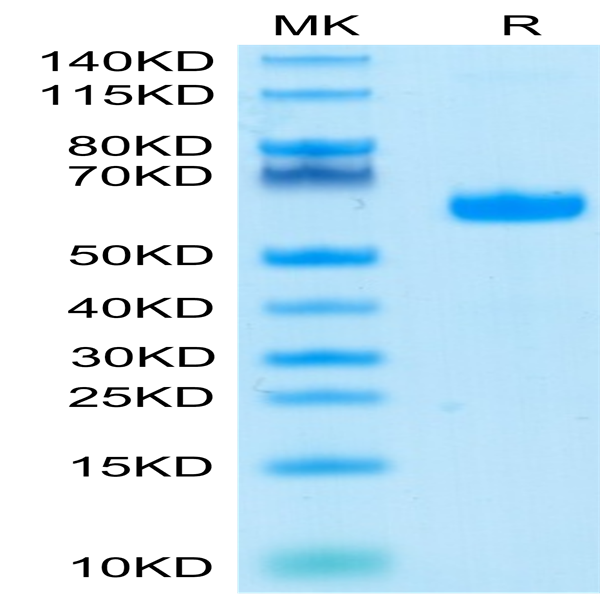 Human LAIR1/CD305 Protein (LAI-HM2R1)