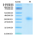 Human LAIR1/CD305 Protein (LAI-HM4R1)