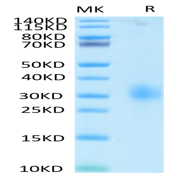 Human LAIR1/CD305 Protein (LAI-HM4R1)