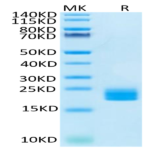 Huma LAIR2/CD306 Protein (LAI-HM4R2)