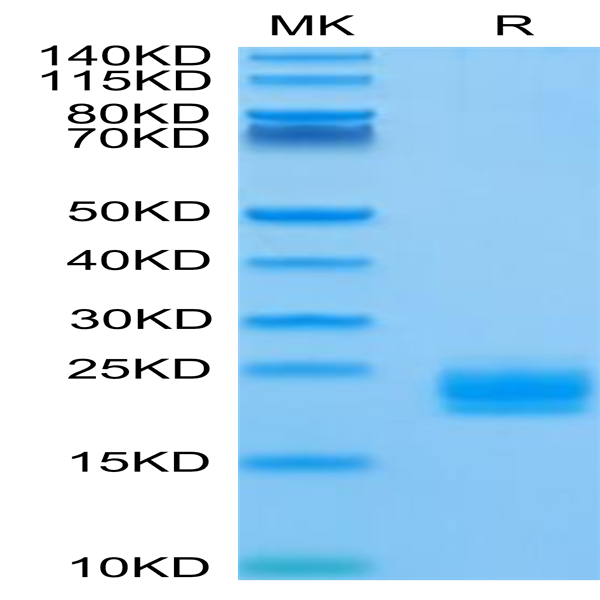 Biotinylated Human LAIR2/CD306 Protein (LAI-HM4R2B)