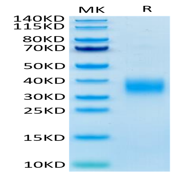 Mouse LAIR1/CD305 Protein (LAI-MM1R1)
