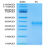 Human LAMP5 Protein (LAM-HM105)