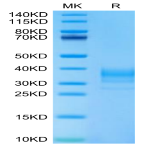 Human LAMP5 Protein (LAM-HM105)
