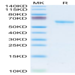 Human LAMP5 Protein (LAM-HM205)