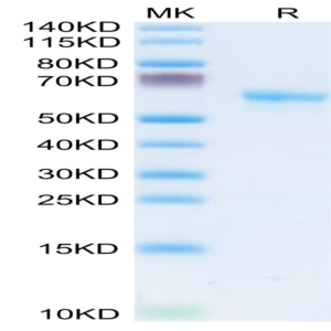 Human LAMP5 Protein (LAM-HM205)