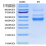 Human LAP (TGF beta 1) Protein (LAP-HM4B1)