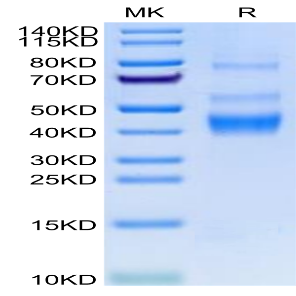Human LAP (TGF beta 1) Protein (LAP-HM4B1)