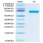 Human LCAT Protein (LAT-HM101)