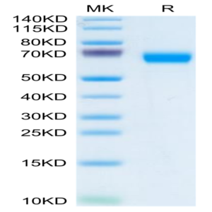 Human LCAT Protein (LAT-HM101)