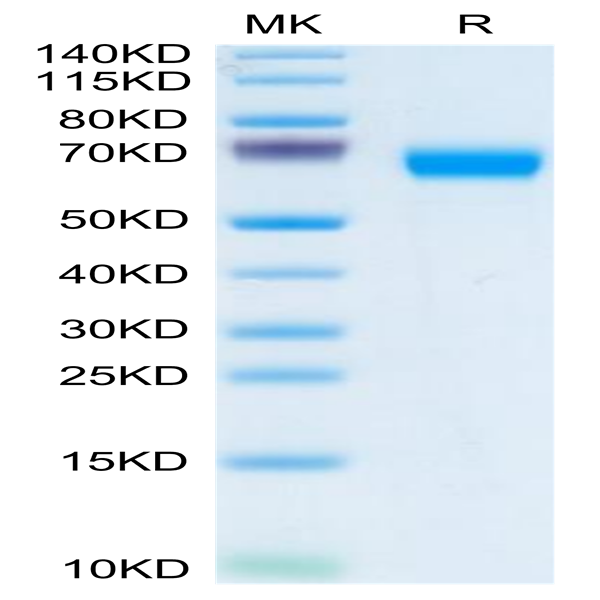 Human LCAT Protein (LAT-HM101)