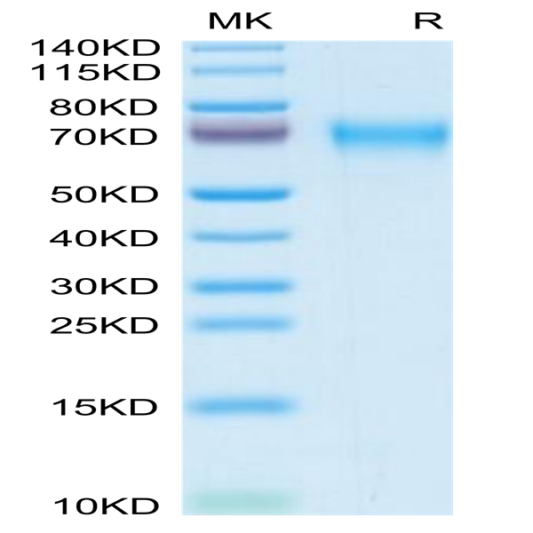 Mouse LCAT Protein (LAT-MM101) Mouse LCAT Protein (LAT-MM101)