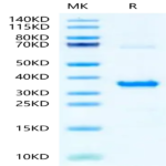 Human NMNAT1 Protein (LCA-HB109)