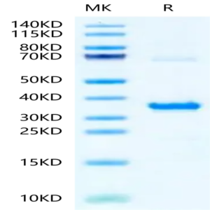 Human NMNAT1 Protein (LCA-HB109)