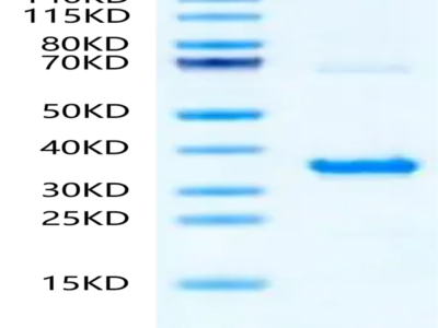 Human NMNAT1 Protein (LCA-HB109)