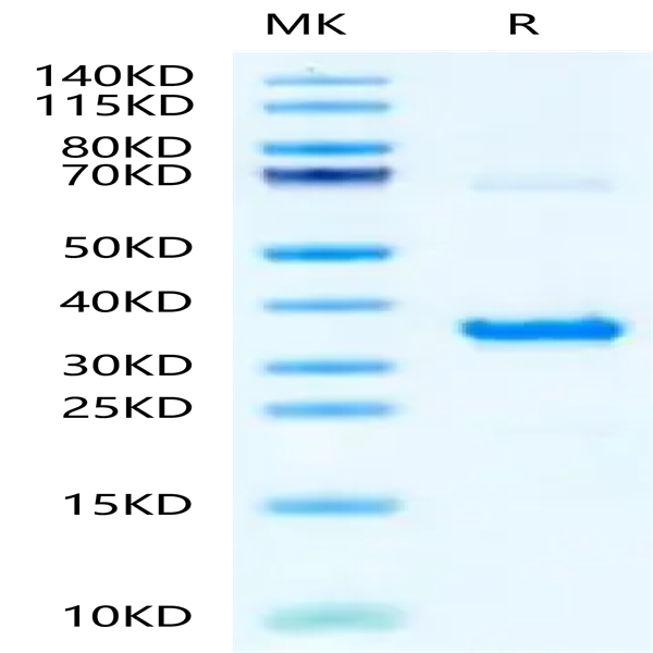 Human NMNAT1 Protein (LCA-HB109) Human NMNAT1 Protein (LCA-HB109)