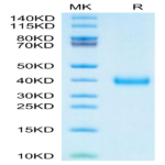 SARS-CoV-2 Spike RBD (Lambda C.37) Protein (LCD-VM1BD)