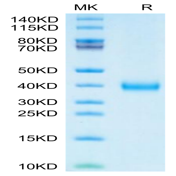 SARS-CoV-2 Spike RBD (Lambda C.37) Protein (LCD-VM1BD)
