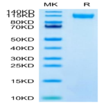 SARS-CoV-2 Spike S1 (Lambda C.37) Protein (LCS-VM1S1)