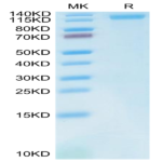 Cynomolgus LDLR Protein (LDL-CM101)