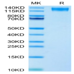 Human LEPR Protein (LEP-HM10R)