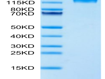 Human LEPR Protein (LEP-HM10R)