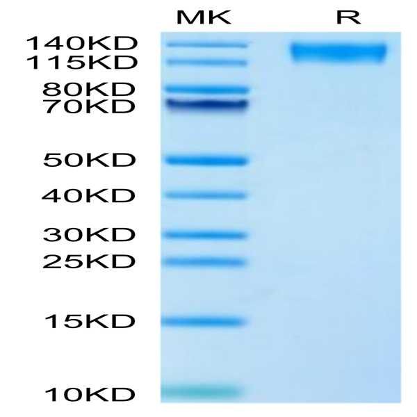 Human LEPR Protein (LEP-HM10R) Human LEPR Protein (LEP-HM10R)
