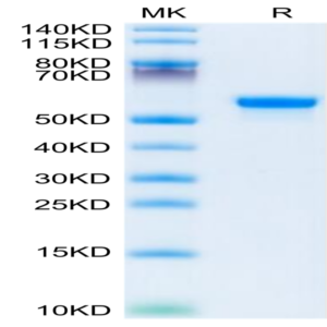 Human LGMN Protein (LGM-HM101)