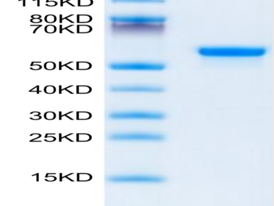 Human LGMN Protein (LGM-HM101)