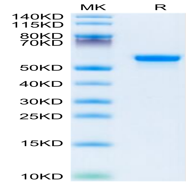 Human LGMN Protein (LGM-HM101) Human LGMN Protein (LGM-HM101)