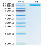 Human LIF R/CD118 Protein (LIF-HM10R)