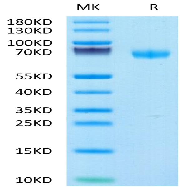 Human LIF Protein (LIF-HM201)