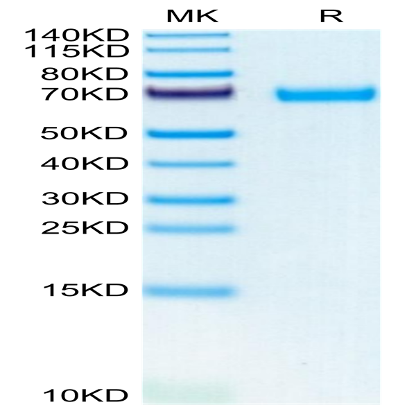 Mouse LIF Protein (LIF-MM201)